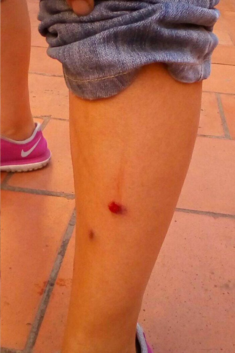 delito-lesiones-españa