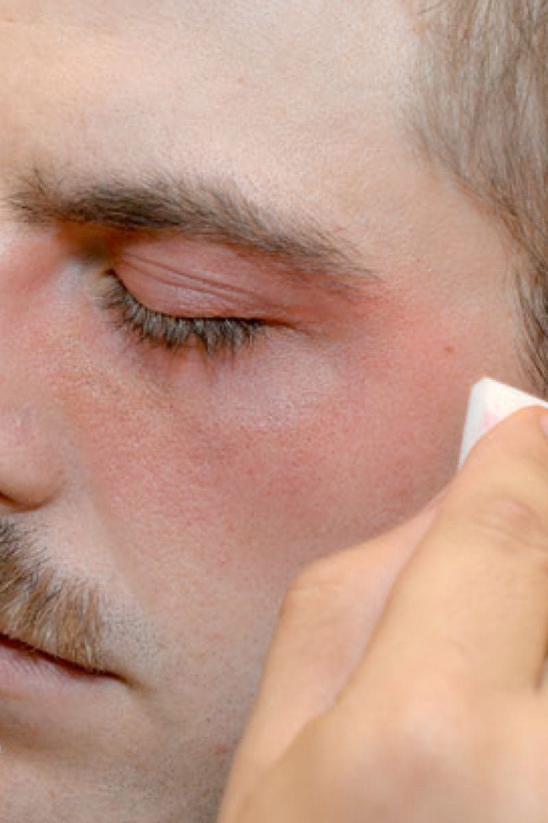 delito de lesiones Madrid